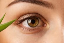 Gerstenkorn Hausmittel: Effektive Tipps zur Linderung und Heilung