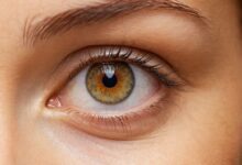 Naturheilmittel gegen grauen Star: Effektive Alternativen zur herkömmlichen Behandlung