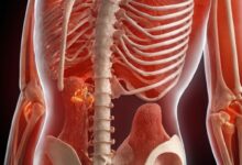 Was entzieht dem Körper Calcium? Ursachen und Lösungen für einen gesunden Mineralhaushalt